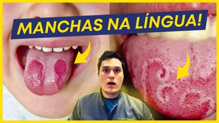 Como Deixar A Lingua Vermelha