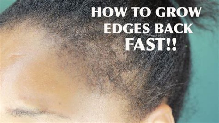 grow edges back